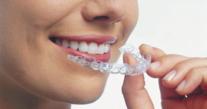 close up of the lower part of a woman's face. She is smiling, her teeth are straight and white, and she is holding an Invisalign clear aligner in her hand.