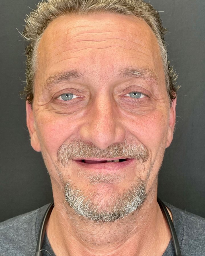 Case 1 before