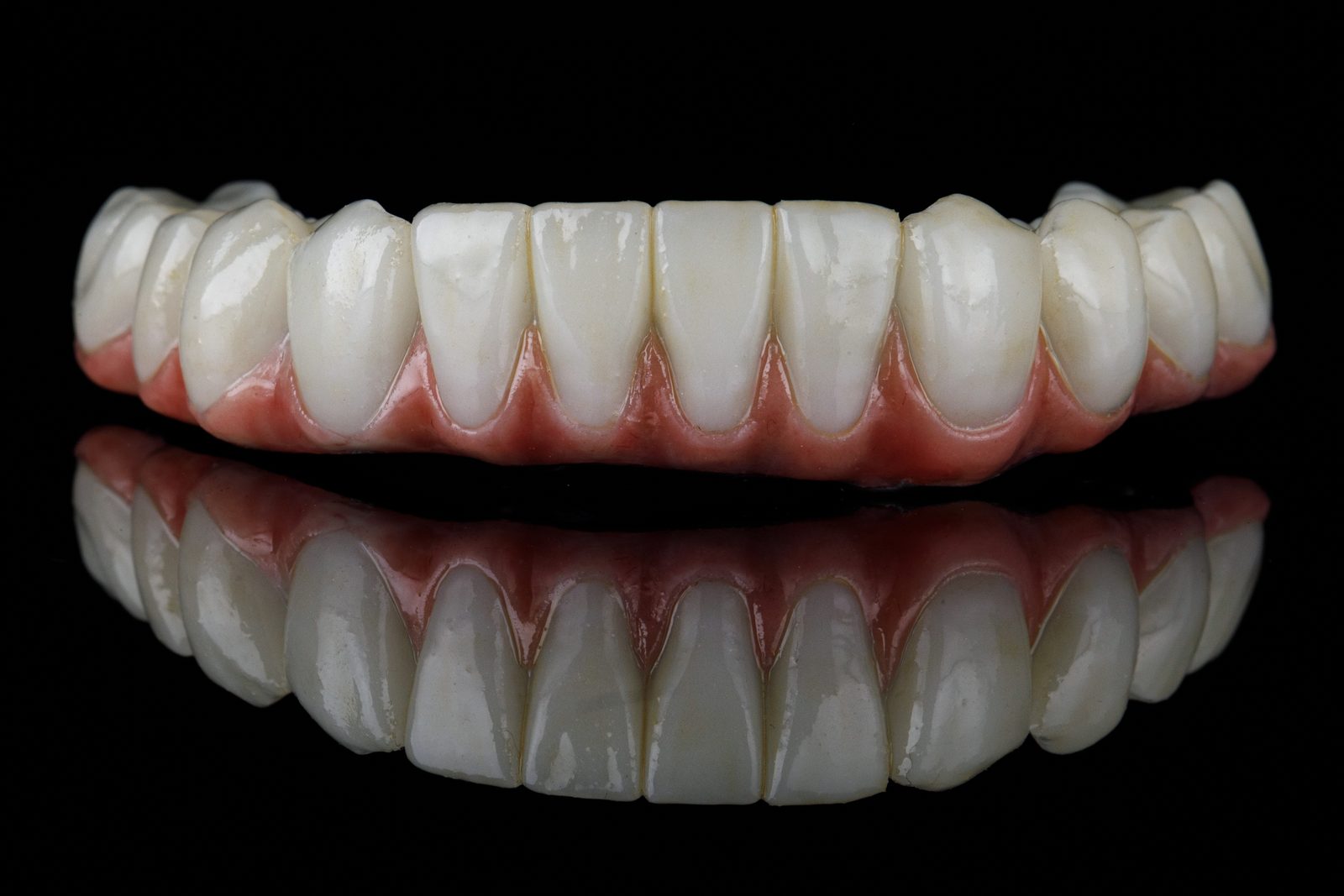 Ceramic crown shade matching