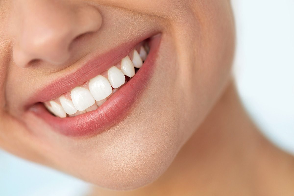 A natural, healthy smile